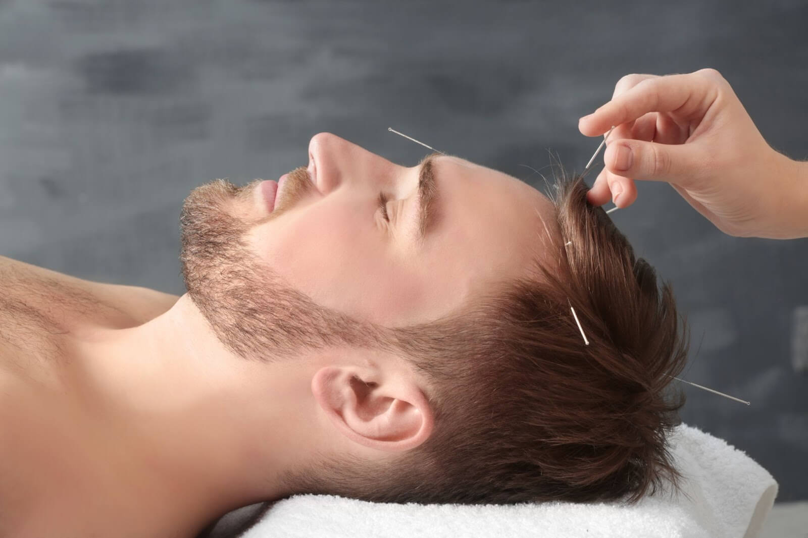 L’acupuncture Therapeute 